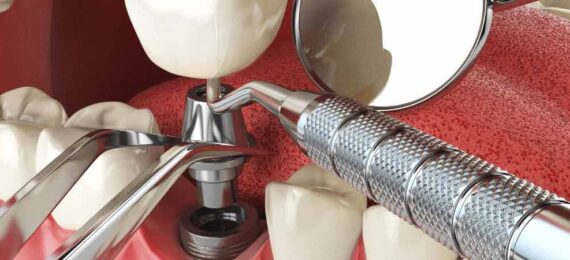 معرفی بهترین شرکت تجهیزات دندانپزشکی